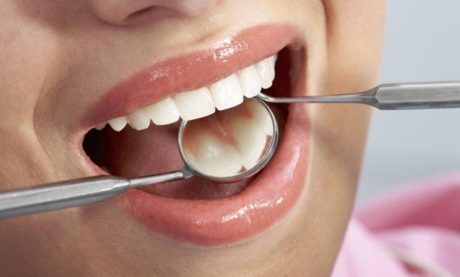 Как укрепить эмаль зубов в домашних условиях